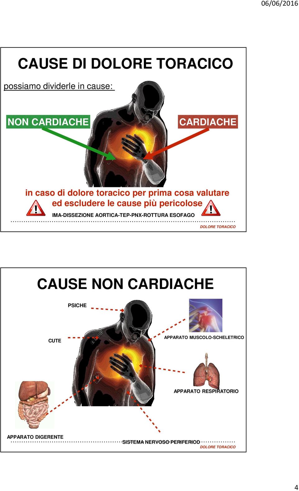 IMA-DISSEZIONE AORTICA-TEP-PNX-ROTTURA ESOFAGO CAUSE NON CARDIACHE PSICHE CUTE