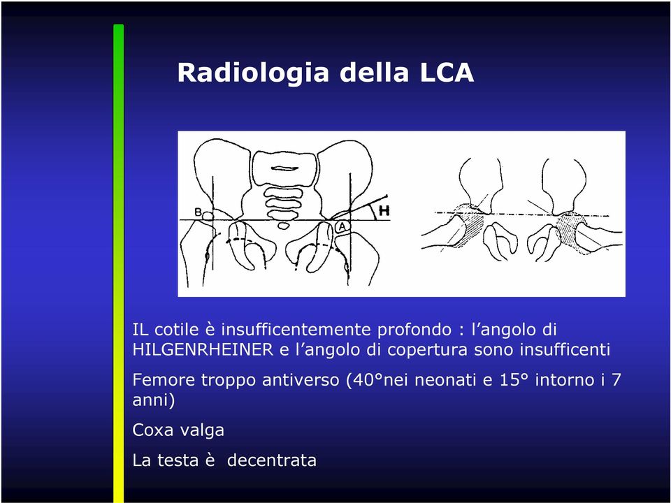 copertura sono insufficenti Femore troppo antiverso (40