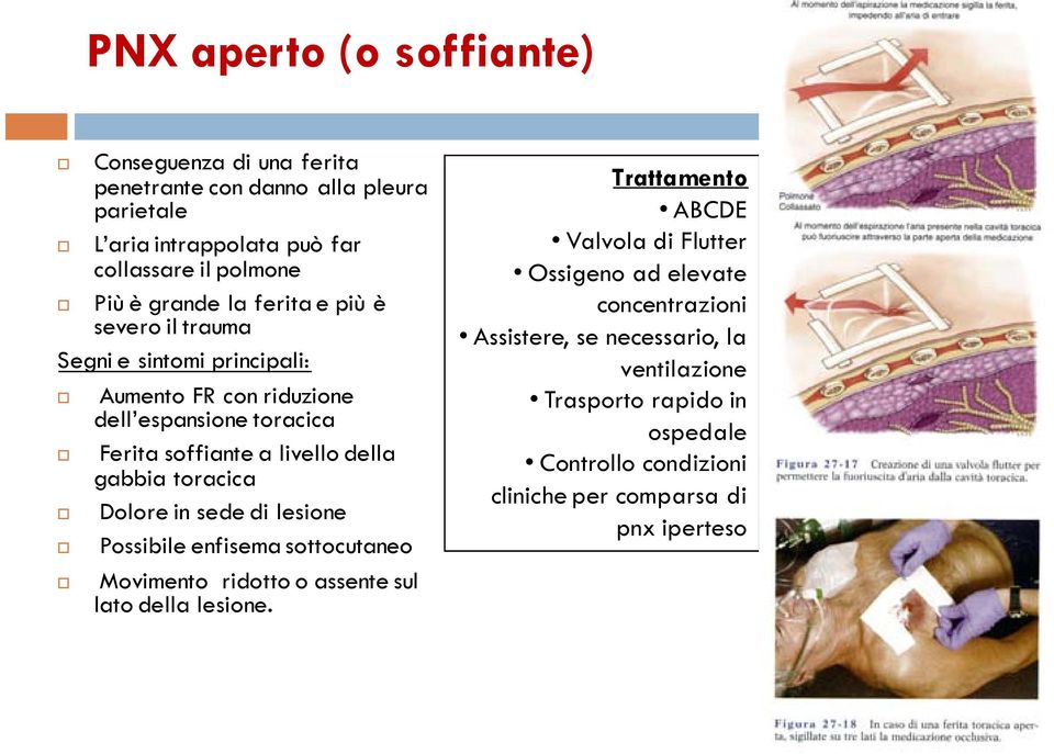 toracica Dolore in sede di lesione Possibile enfisema sottocutaneo Movimento ridotto o assente sul lato della lesione.