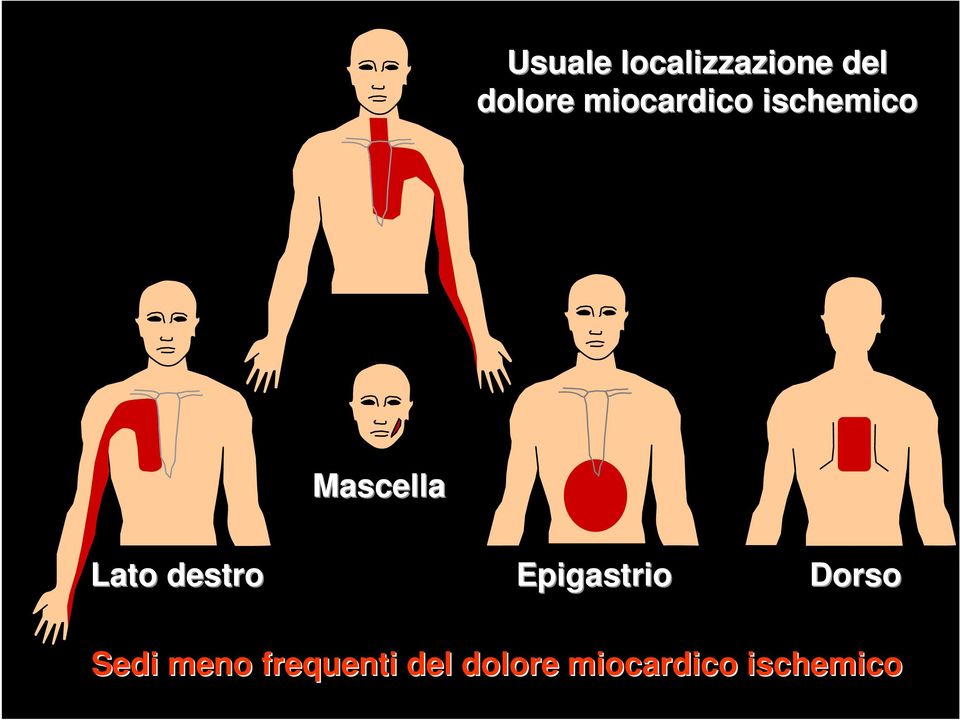 destro Epigastrio Dorso Sedi meno