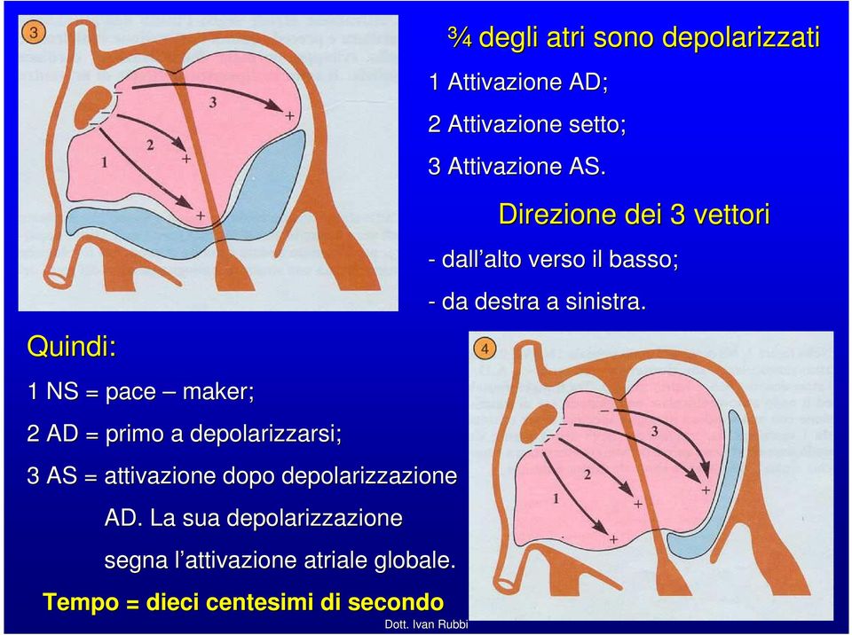 Tempo = dieci centesimi di secondo ¾ degli atri sono depolarizzati 1 Attivazione AD; 2