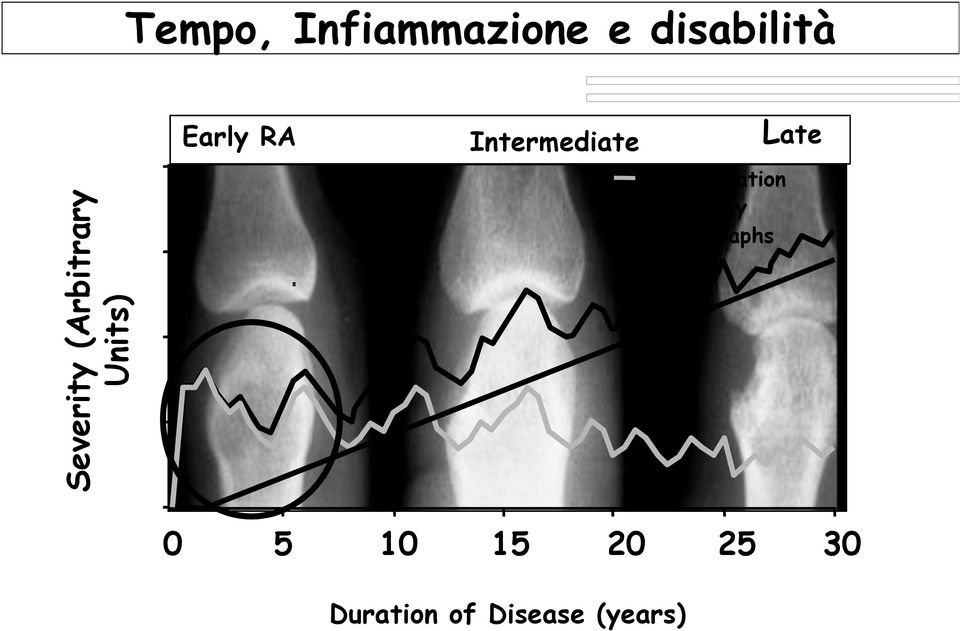 Inflammation Disability Radiographs Late 0