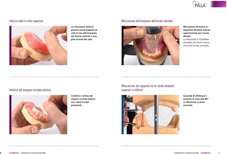 Misurazione attraverso un dispositivo flessibile indicato appositamente per l arcata dentale. La flessibilità di PalaMeter permette una facile misurazione dell arcata completa.