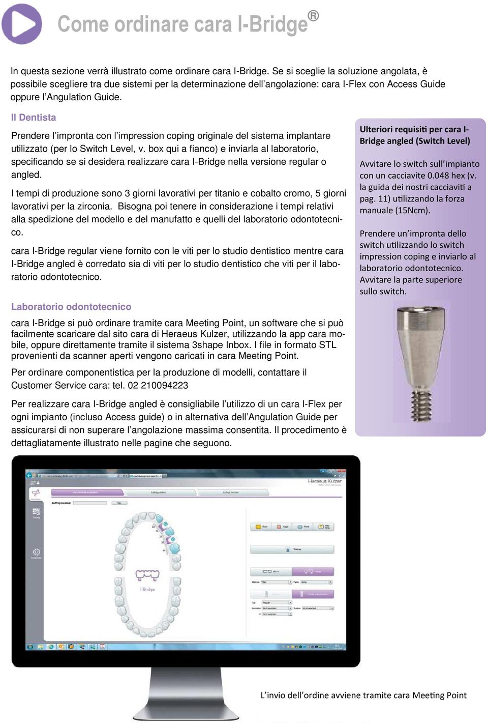 Il Dentista Prendere l impronta con l impression coping originale del sistema implantare utilizzato (per lo Switch Level, v.