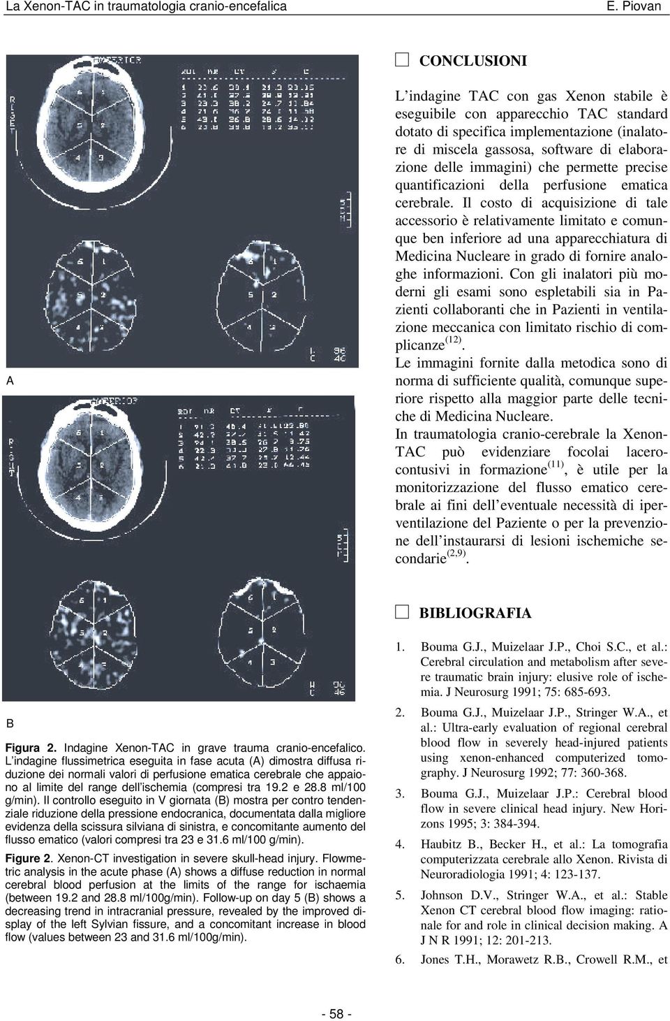 immagini) che permette precise quantificazioni della perfusione ematica cerebrale.