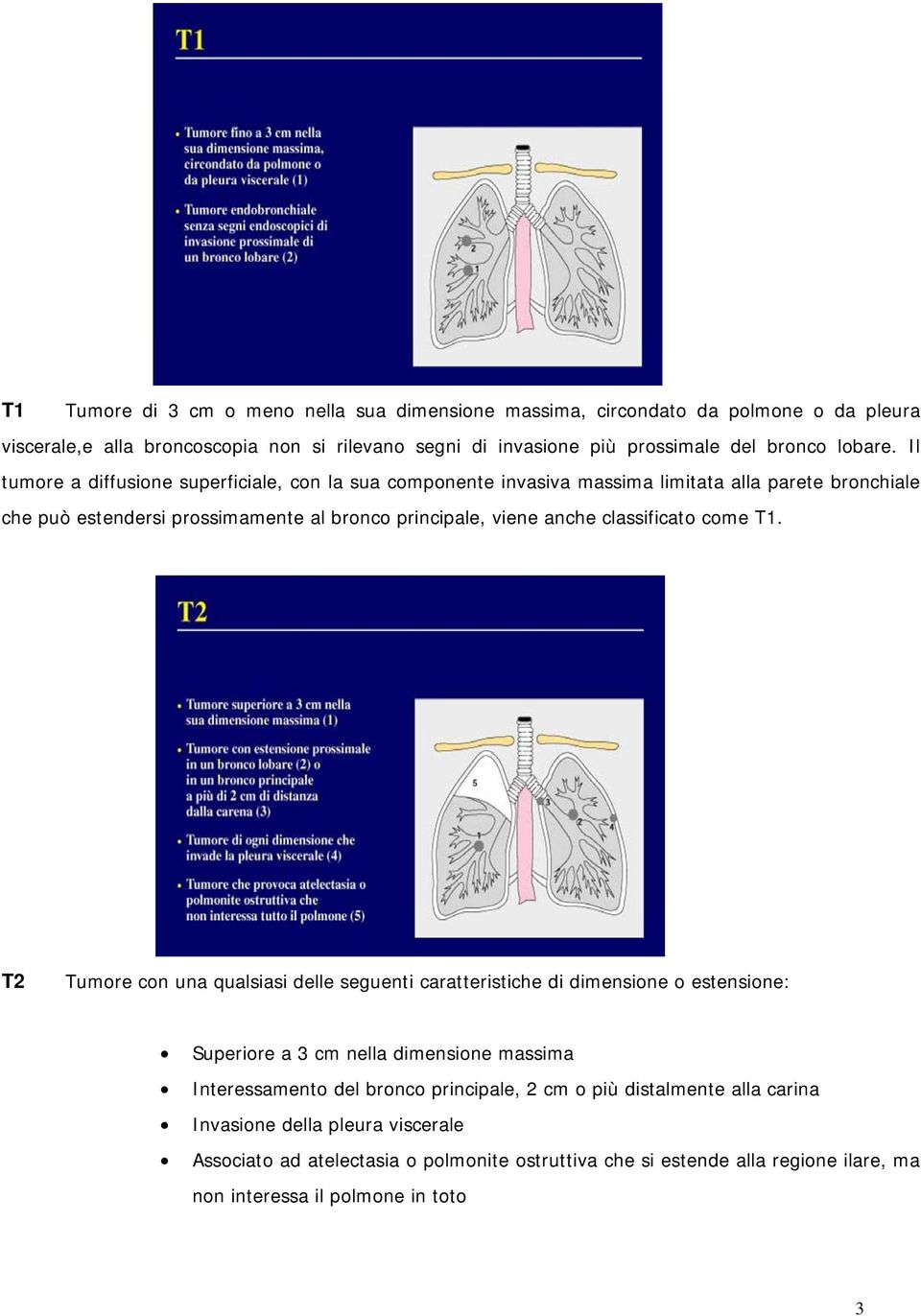 Il tumore a diffusione superficiale, con la sua componente invasiva massima limitata alla parete bronchiale che può estendersi prossimamente al bronco principale, viene anche