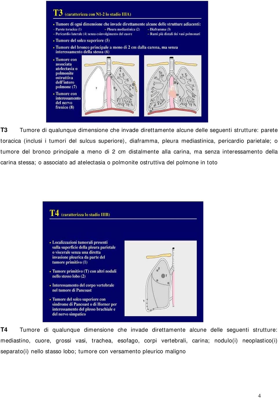 associato ad atelectasia o polmonite ostruttiva del polmone in toto T4 Tumore di qualunque dimensione che invade direttamente alcune delle seguenti strutture: