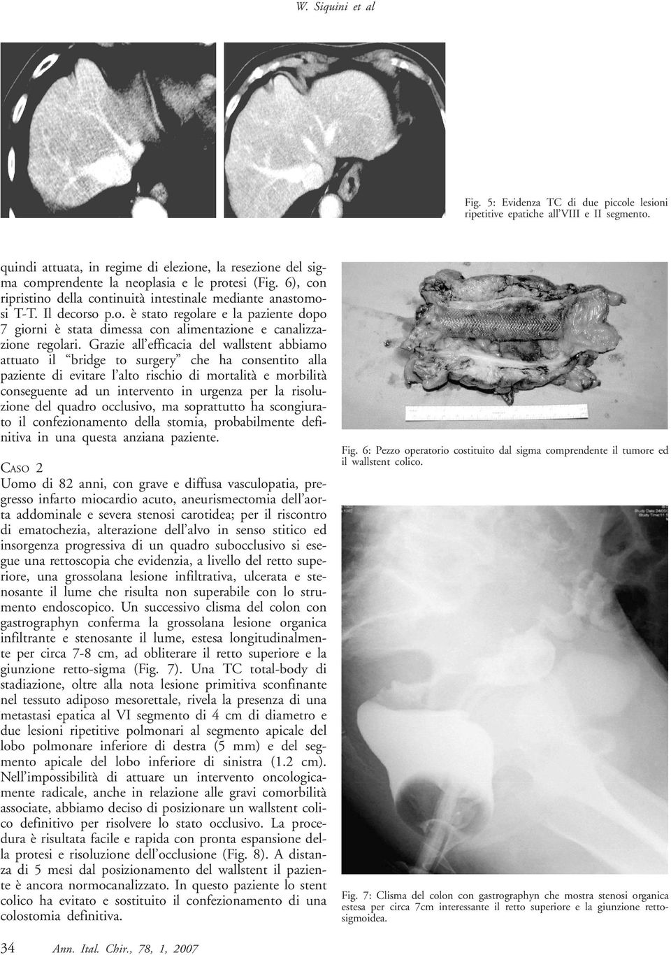 Grazie all efficacia del wallstent abbiamo attuato il bridge to surgery che ha consentito alla paziente di evitare l alto rischio di mortalità e morbilità conseguente ad un intervento in urgenza per