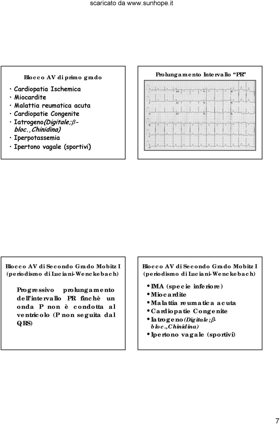 ,Chinidina) Iperpotassemia Ipertono vagale (sportivi) Blocco AV di Secondo Grado Mobitz I (periodismo di Luciani-Wenckebach) Progressivo prolungamento