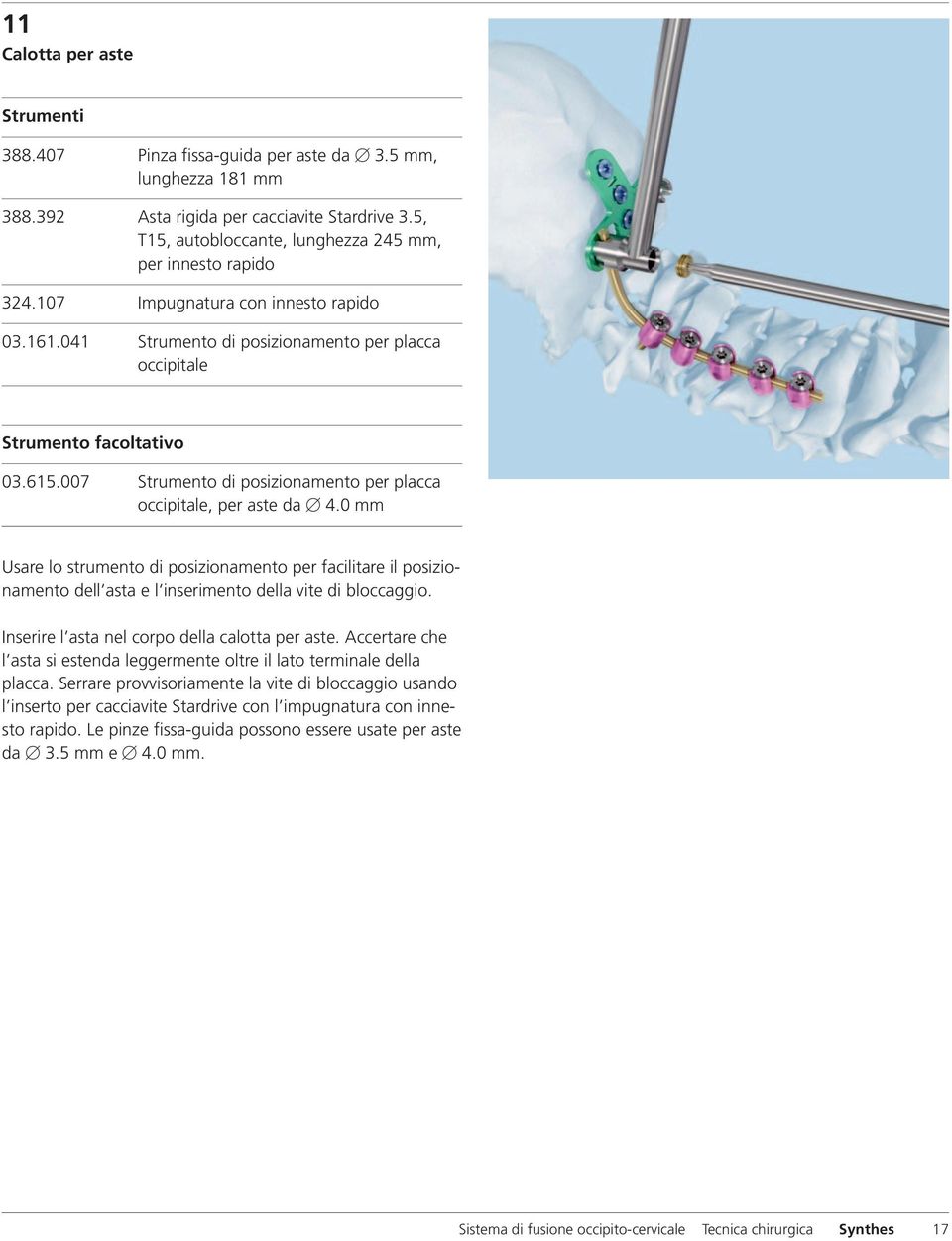 007 Strumento di posizionamento per placca occipitale, per aste da 4.0 mm Usare lo strumento di posizionamento per facilitare il posizionamento dell asta e l inserimento della vite di bloccaggio.