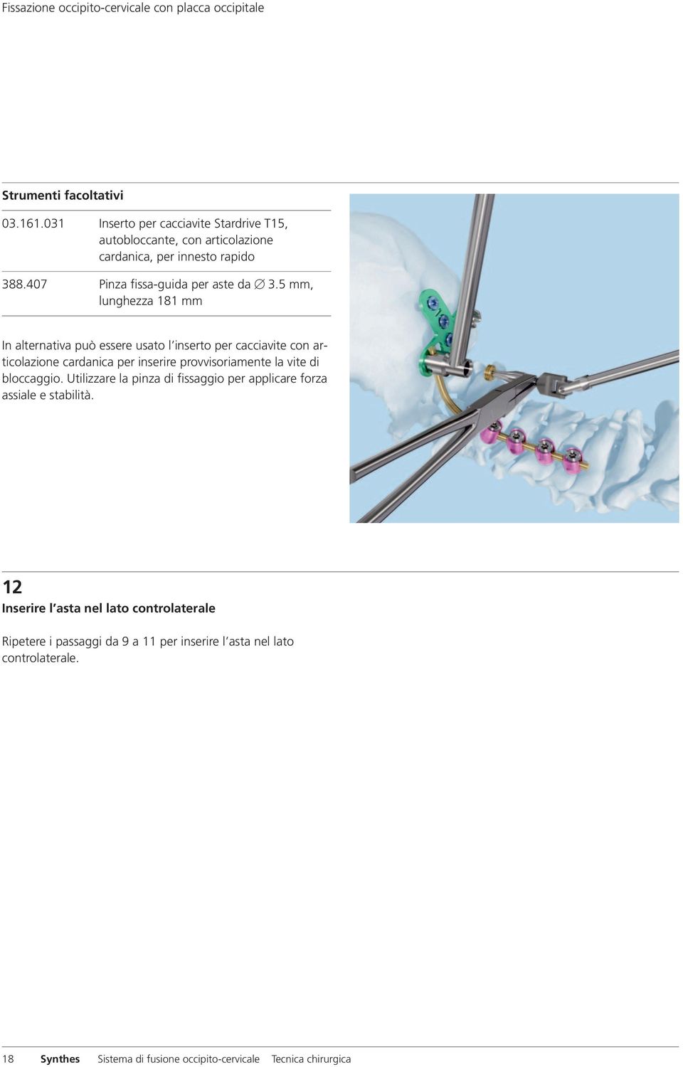 5 mm, lunghezza 181 mm In alternativa può essere usato l inserto per cacciavite con articolazione cardanica per inserire provvisoriamente la vite di bloccaggio.