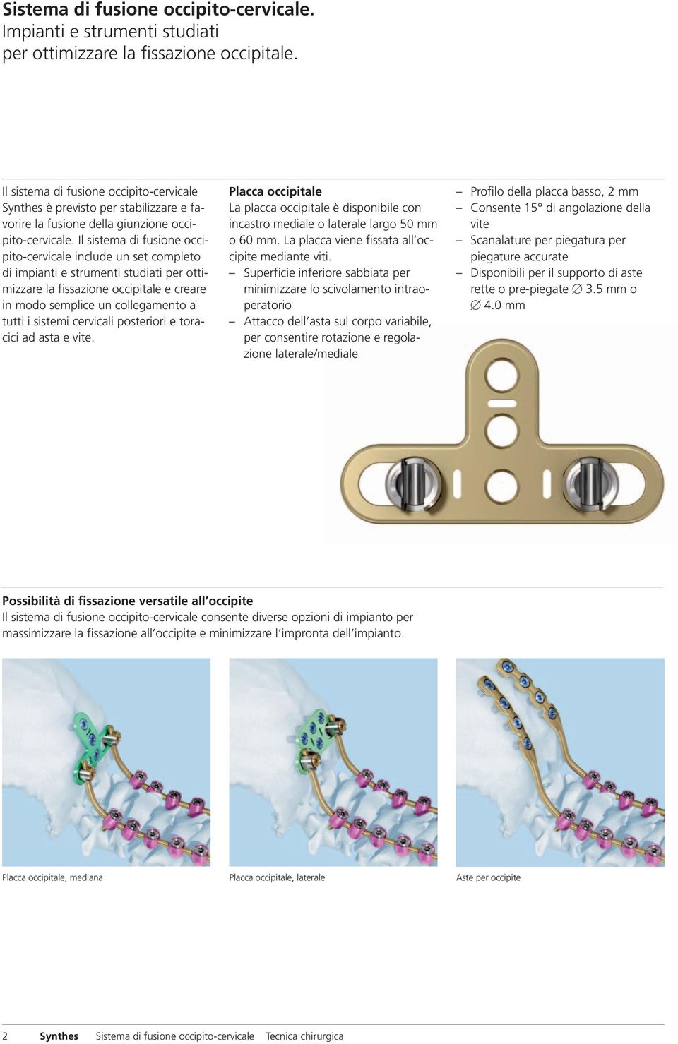 Il sistema di fusione occipito-cervicale include un set completo di impianti e strumenti studiati per ottimizzare la fissazione occipitale e creare in modo semplice un collegamento a tutti i sistemi