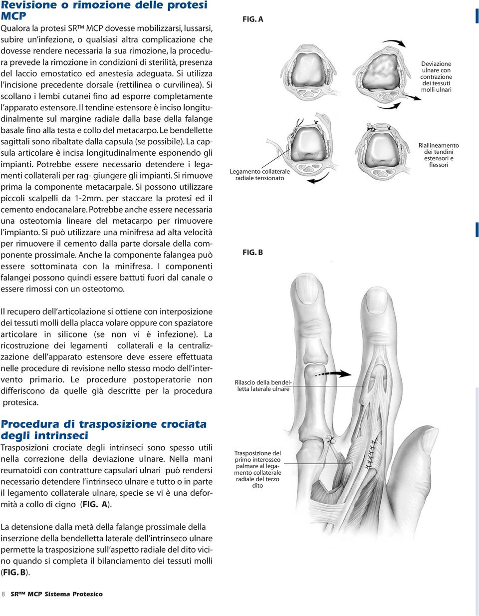 Si scollano i lembi cutanei fino ad esporre completamente l apparato estensore.