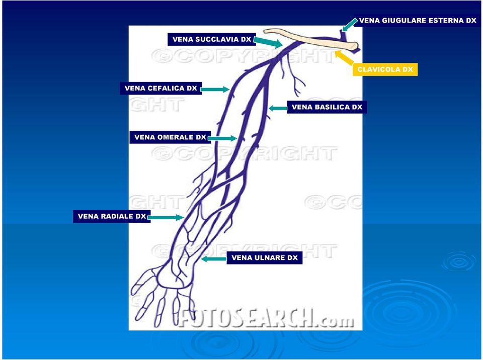 CEFALICA DX VENA BASILICA DX VENA