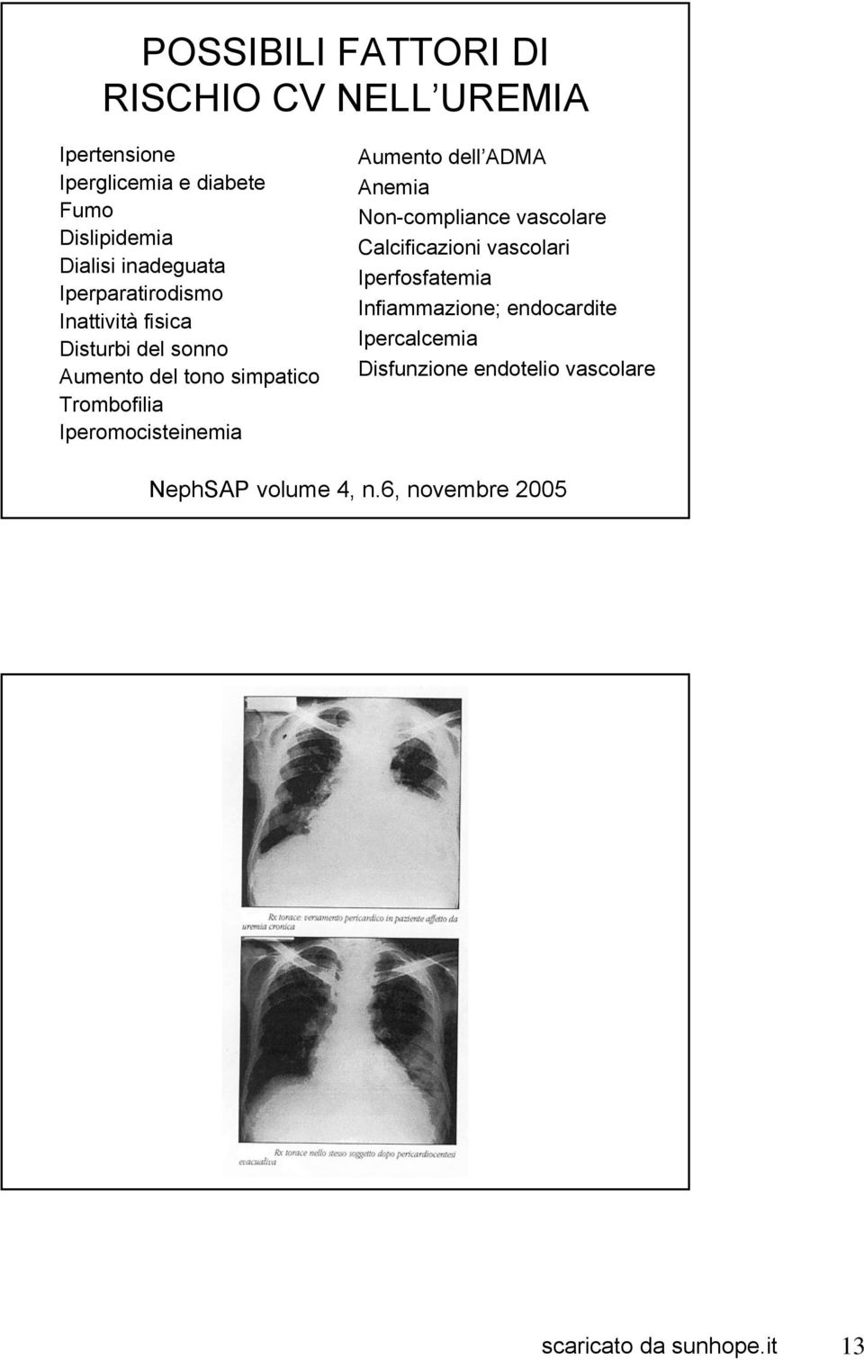 Iperomocisteinemia Aumento dell ADMA Anemia Non-compliance vascolare Calcificazioni vascolari