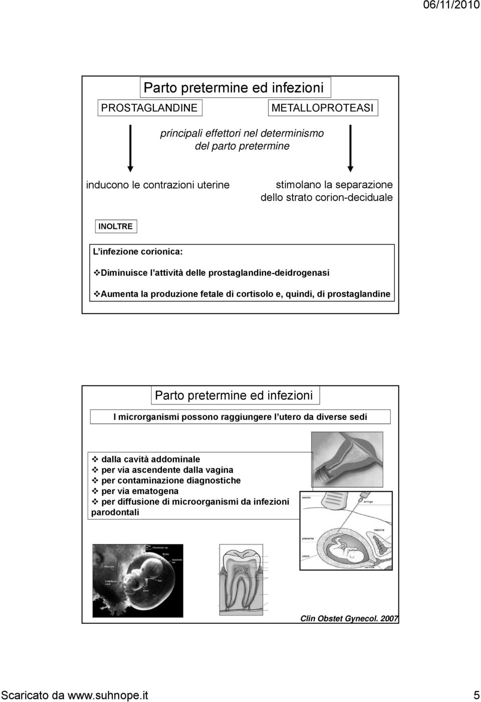 e, quindi, di prostaglandine I microrganismi possono raggiungere l utero da diverse sedi dalla cavità addominale per via ascendente dalla vagina per