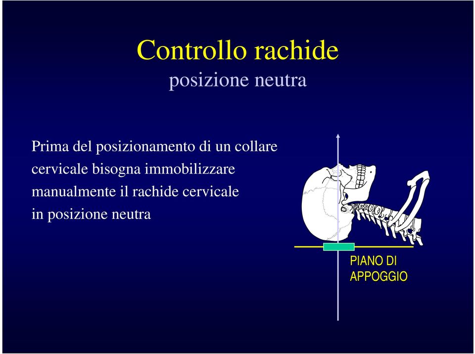 bisogna immobilizzare manualmente il