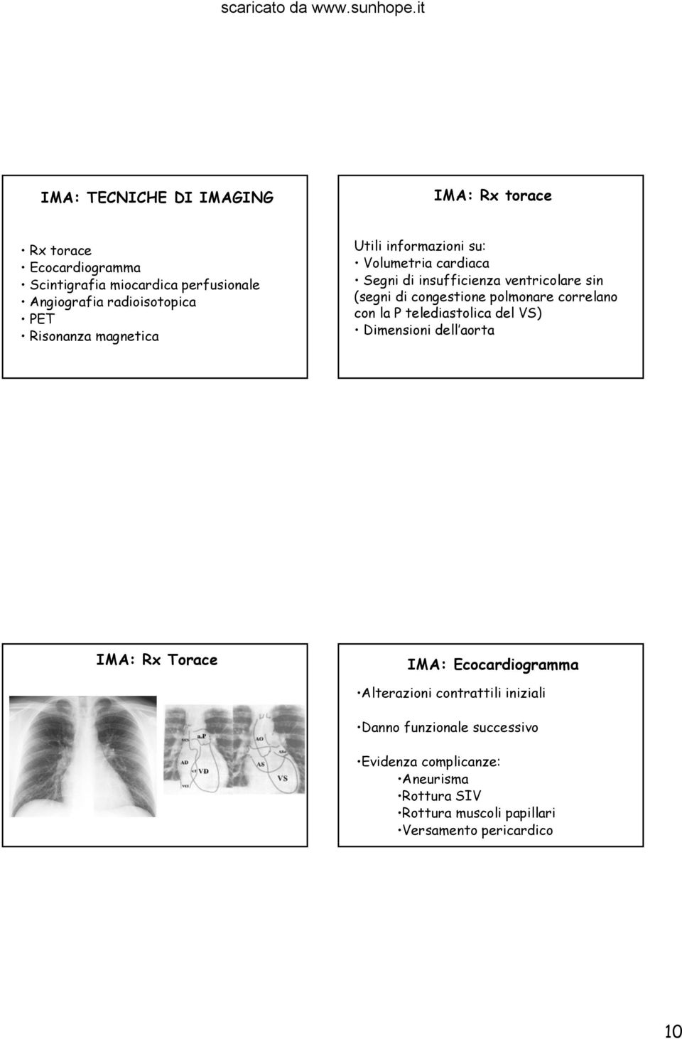 polmonare correlano con la P telediastolica del VS) Dimensioni dell aorta IMA: Rx Torace IMA: Ecocardiogramma Alterazioni