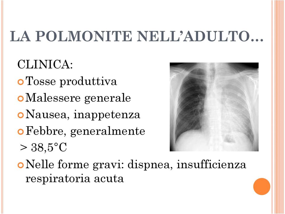 inappetenza Febbre, generalmente > 38,5 C