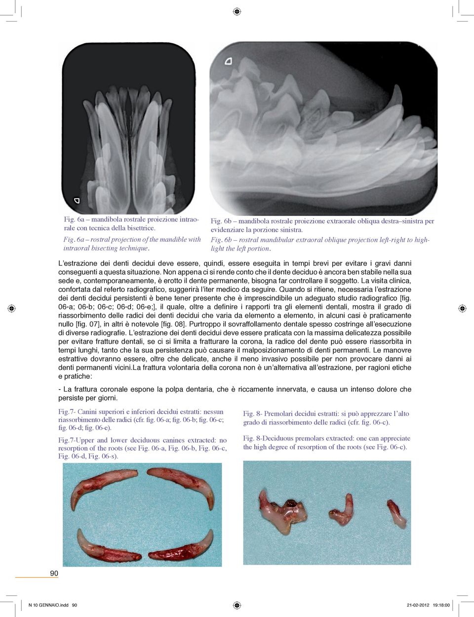 L estrazione dei denti decidui deve essere, quindi, essere eseguita in tempi brevi per evitare i gravi danni conseguenti a questa situazione.