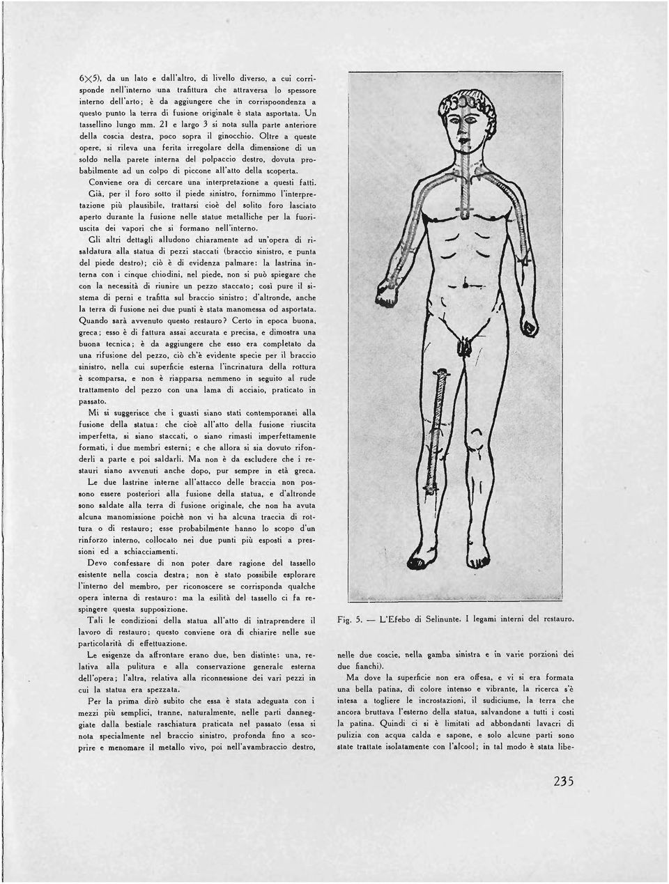 Oltre a queste apere, si rileva una ferita irregolare della dimensione di un saldo nella parete interna dei polpaeeio destro, dovuta probabilmente ad un eolpo di pieeone all'atto della seoperta.