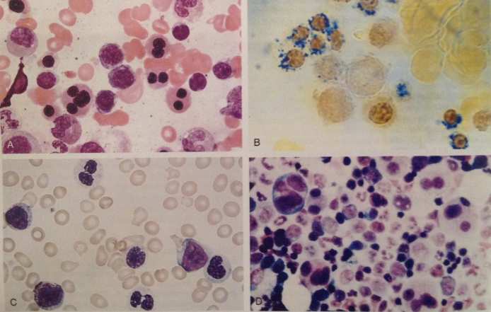 Indicatori cito-istopatologici Clinici