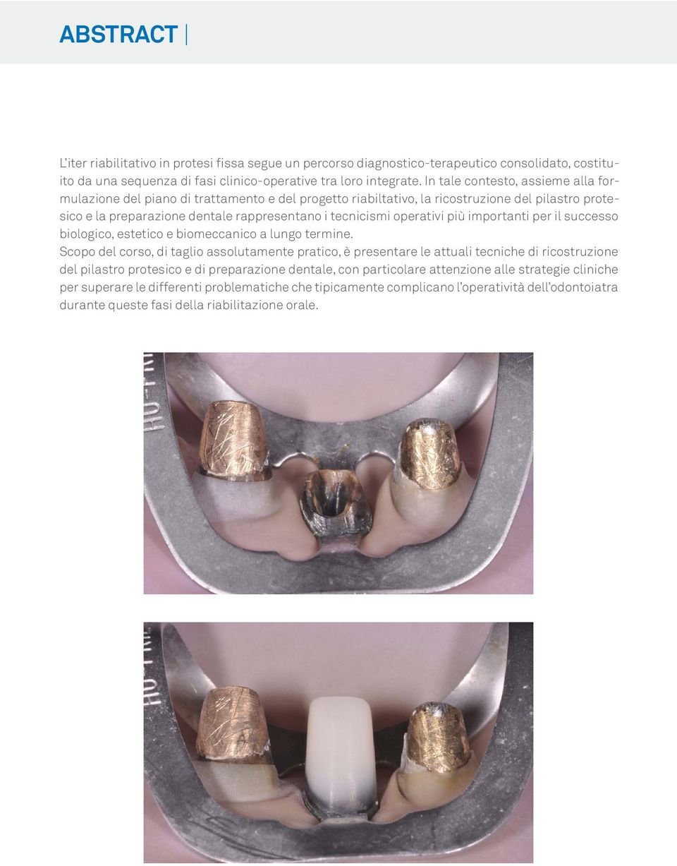 operativi più importanti per il successo biologico, estetico e biomeccanico a lungo termine.
