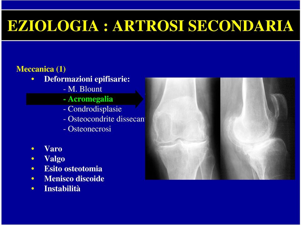 Blount - Acromegalia - Condrodisplasie -