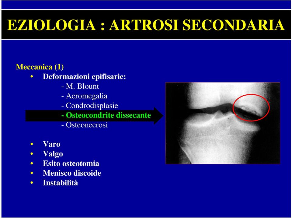 Blount - Acromegalia - Condrodisplasie -