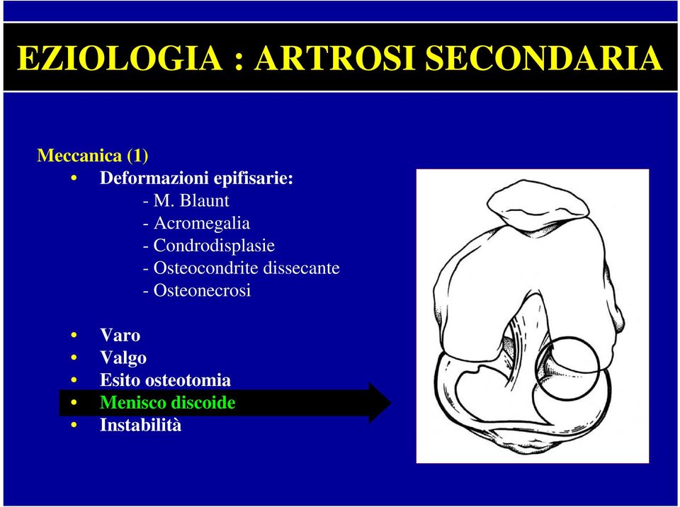 Blaunt - Acromegalia - Condrodisplasie -