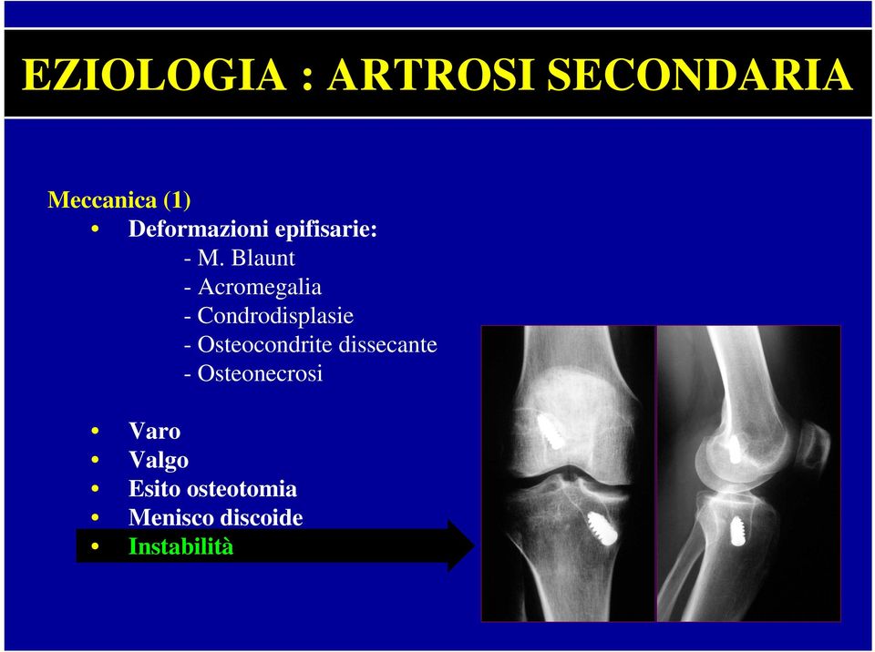 Blaunt - Acromegalia - Condrodisplasie -