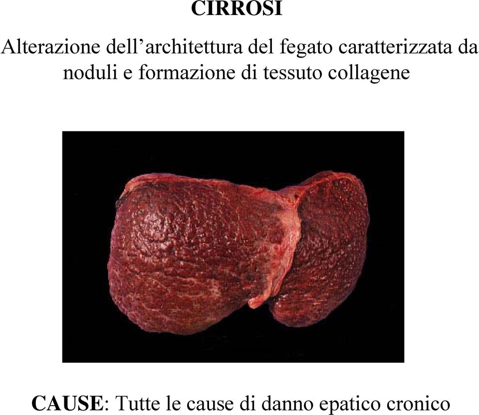 formazione di tessuto collagene CAUSE:
