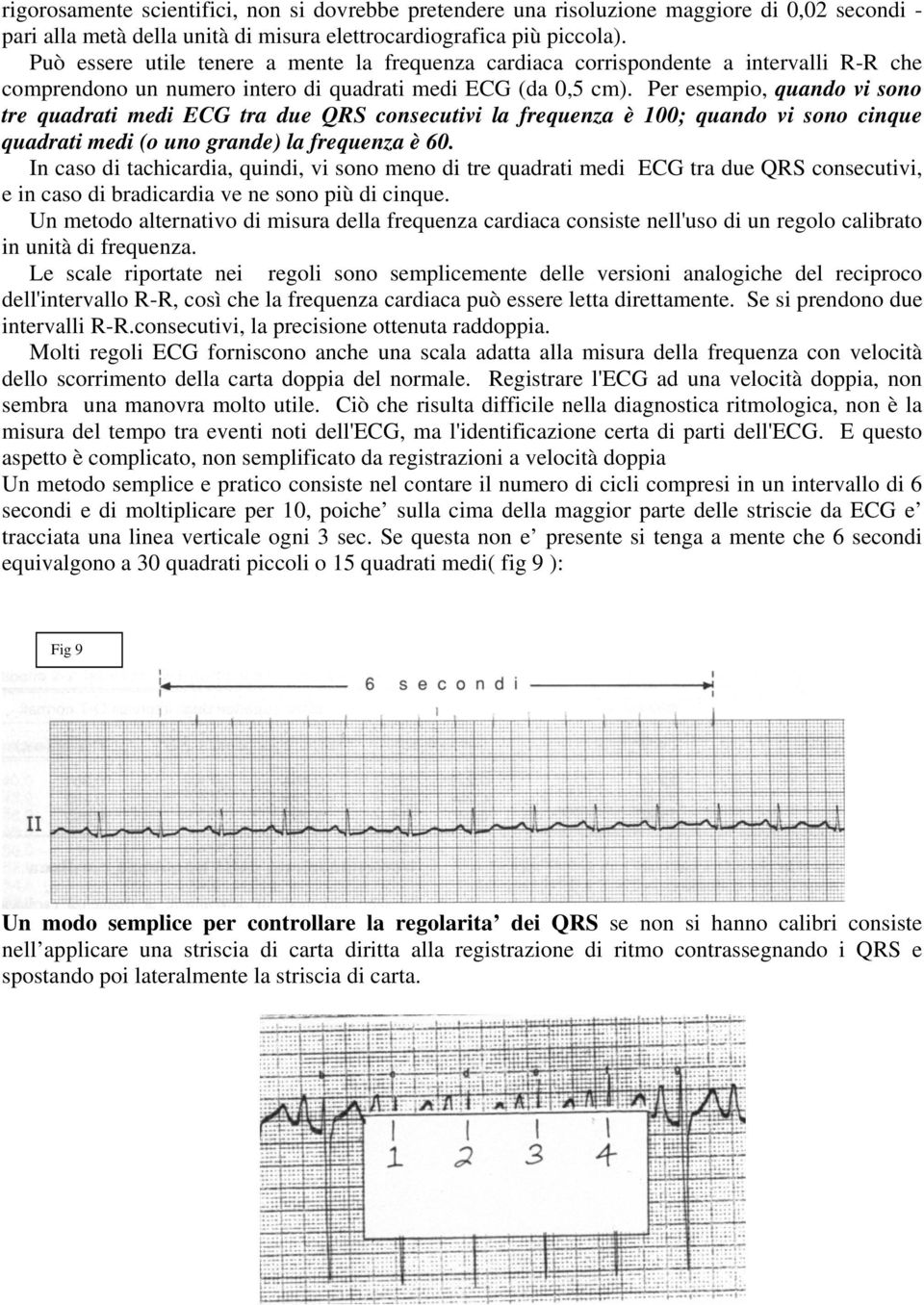 Per esempio, quando vi sono tre quadrati medi ECG tra due QRS consecutivi la frequenza è 100; quando vi sono cinque quadrati medi (o uno grande) la frequenza è 60.