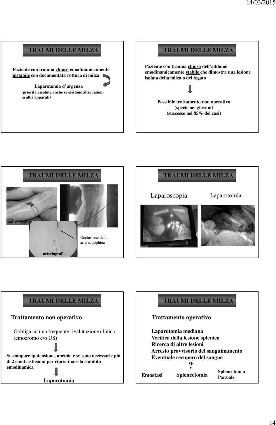 (successo nel 85% dei casi) TRAUMI DELLA DELLE MILZA TRAUMI DELLA DELLE MILZA Laparoscopia Laparotomia Occlusione della arteria poplitea arteriografia TRAUMI DELLE MILZA Trattamento non operativo