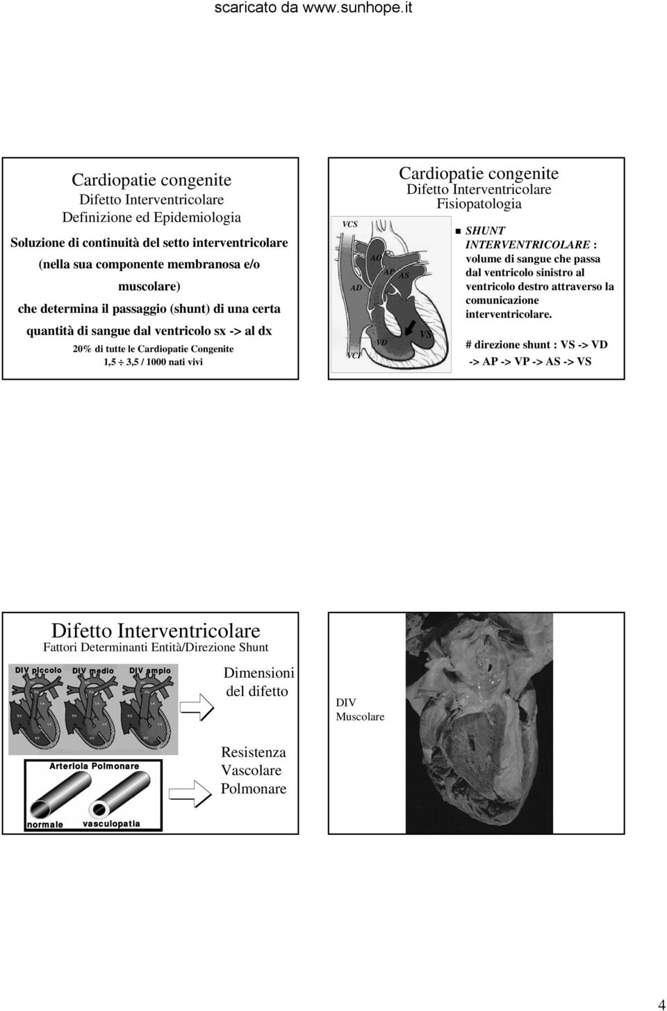 volume di sangue che passa dal ventricolo sinistro al ventricolo destro attraverso la comunicazione interventricolare.