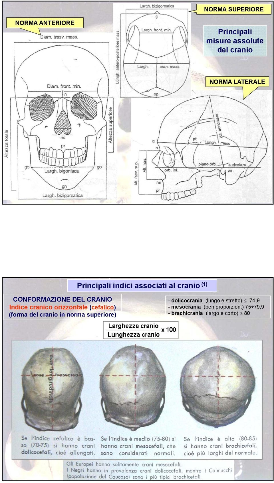 orizzontale (cefalico) (forma del cranio in norma superiore) - dolicocrania (lungo e