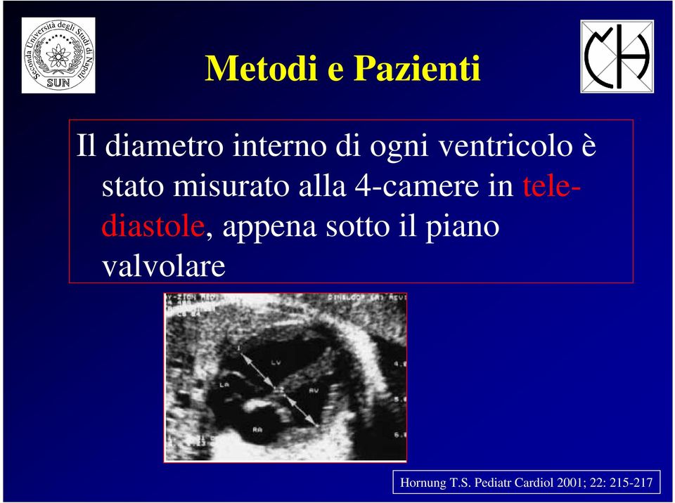 telediastole, appena sotto il piano valvolare