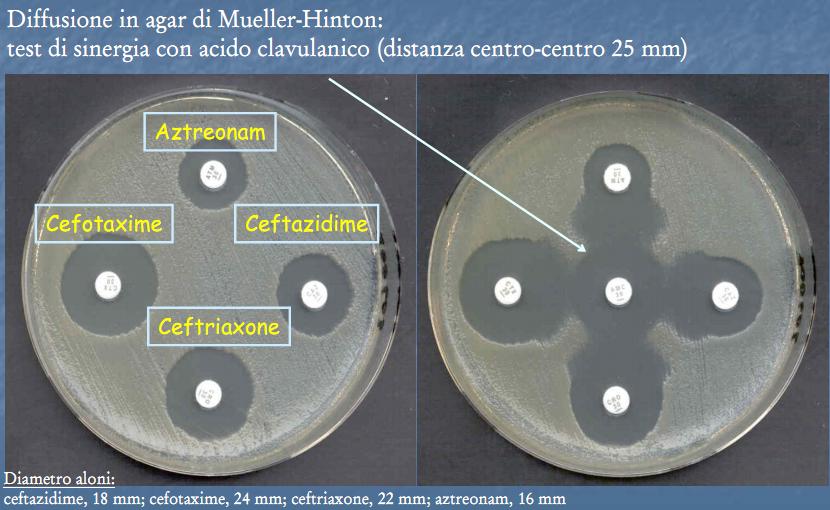 Test di screening e di conferma ai fini epidemiologici per la valutazione della presenza di ESBL K.pneumoniae, E.coli, P.