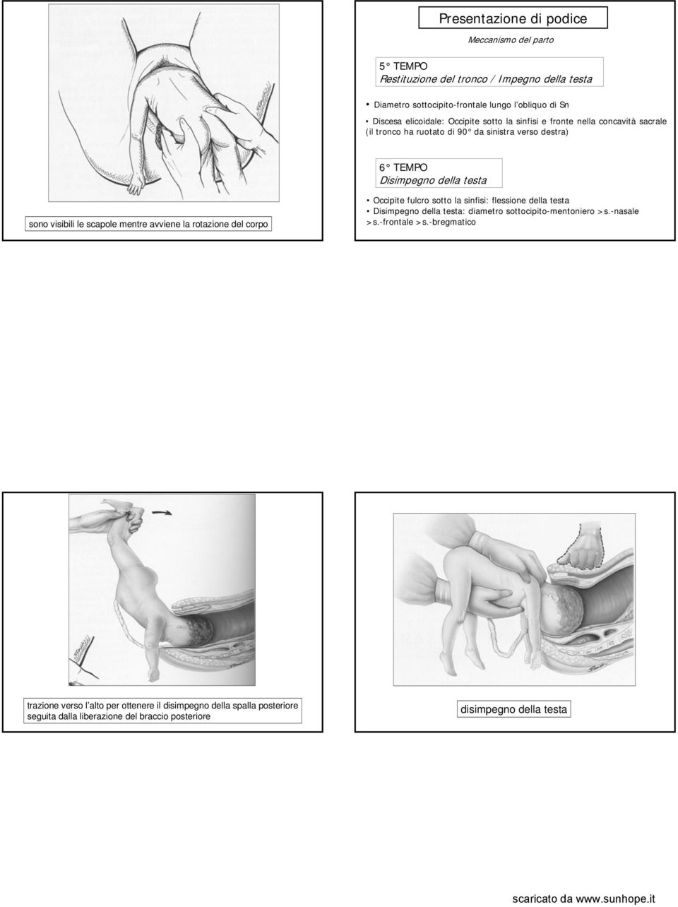 visibili le scapole mentre avviene la rotazione del corpo Occipite fulcro sotto la sinfisi: flessione della testa Disimpegno della testa: diametro