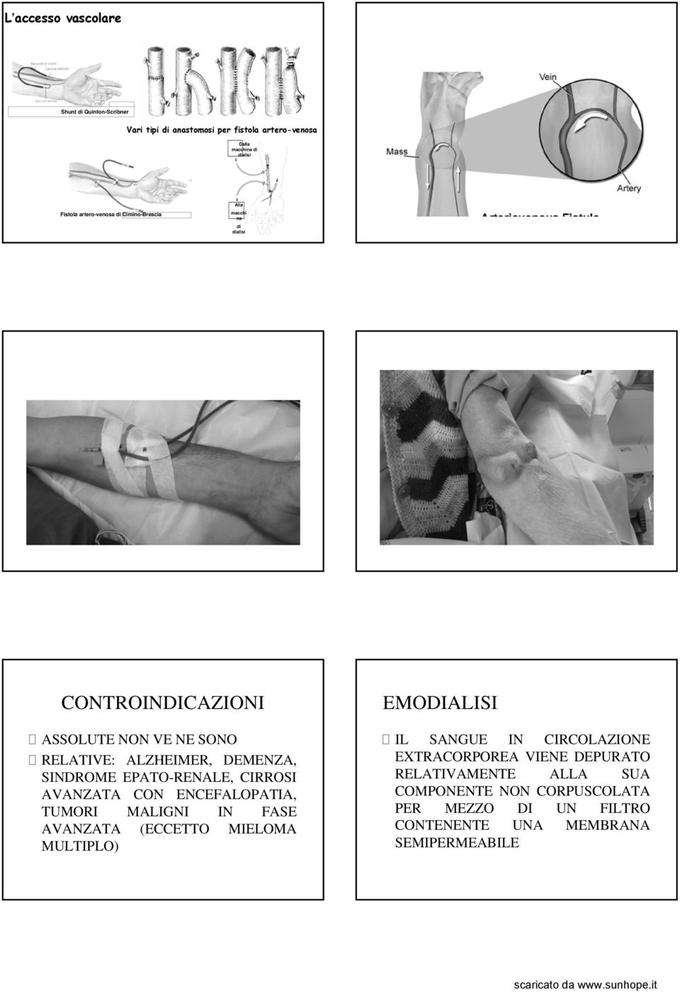 EPATO-RENALE, CIRROSI AVANZATA CON ENCEFALOPATIA, TUMORI MALIGNI IN FASE AVANZATA (ECCETTO MIELOMA MULTIPLO) IL SANGUE IN CIRCOLAZIONE