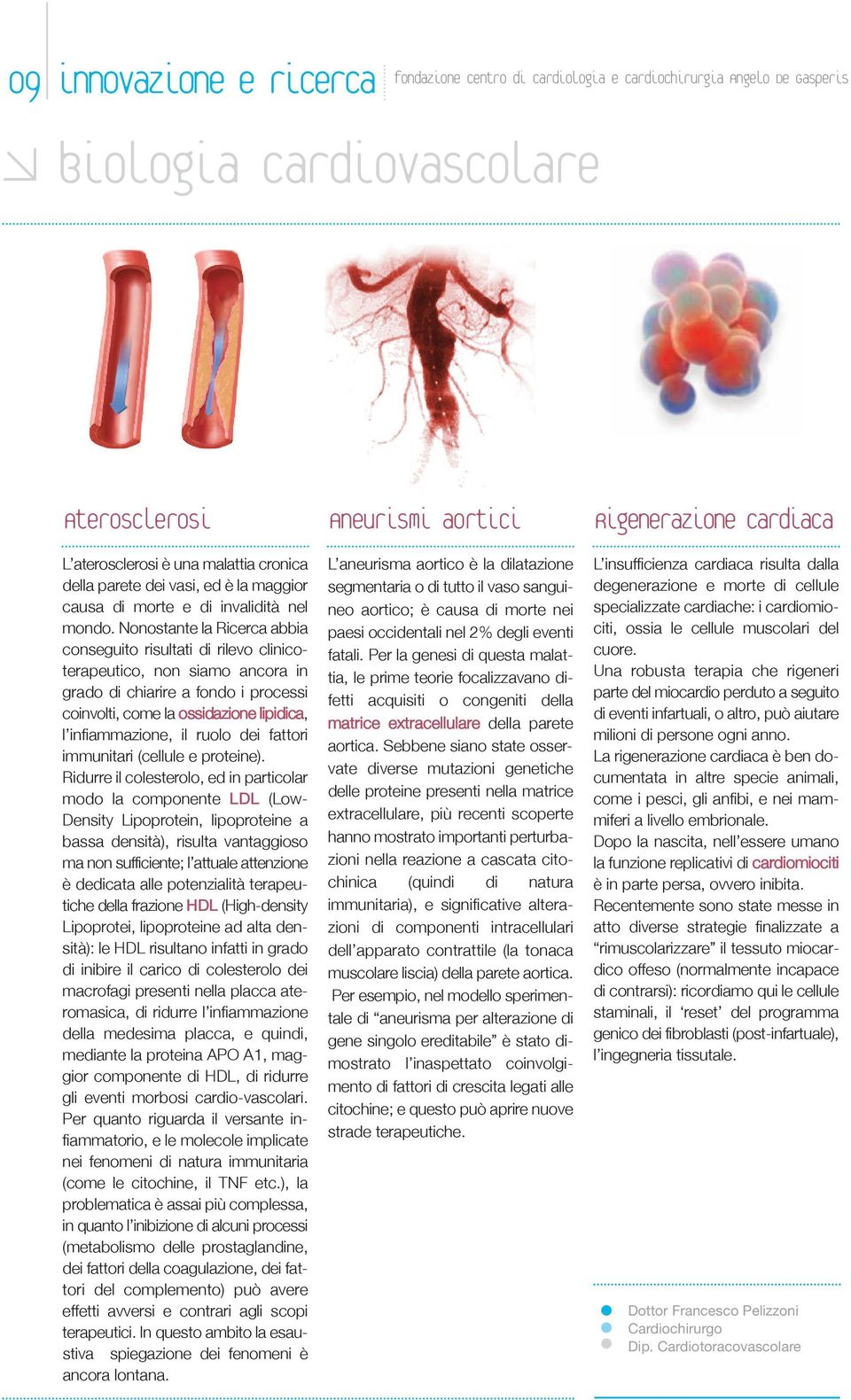 Nonostante la Ricerca abbia conseguito risultati di rilevo clinicoterapeutico, non siamo ancora in grado di chiarire a fondo i processi coinvolti, come la ossidazione lipidica, l infiammazione, il