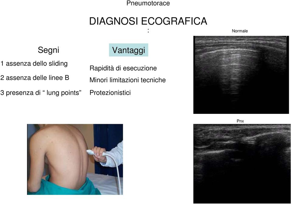 presenza di lung points Vantaggi Rapidità di