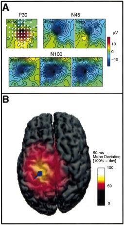 TMS & tdcs a confronto: TMS => neuro-stimolazione - maggiore focalità - costo relativamente elevato - addestramento prolungato STIMOLAZION ONLIN: CRONOMTRIA MNTAL Tecniche di stimolazione