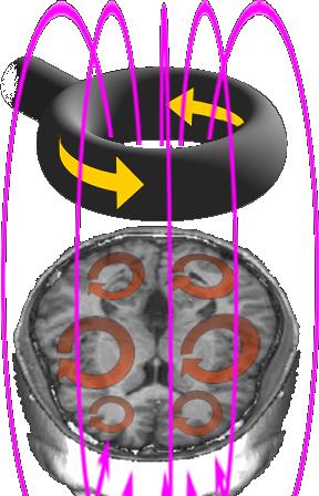 indotto attraversa lo scalpo e induce un campo elettrico nel tessuto nervoso, il secondo conduttore Meccanismi di stimolazione Neurone Rest TMS Depolarizazione Meccanismi di stimolazione Principi di