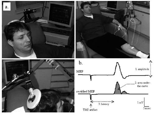 Attività vocata: Potenziali vocati Motori (motor-evoked potentials, MPs) Attività evocata M1 Coil posto su corteccia motoria primaria Attività evocata Depolarizzazione di neuroni motori attività MG