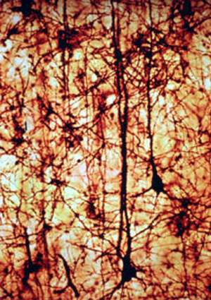 Il tessuto nervoso è una rete di neuroni