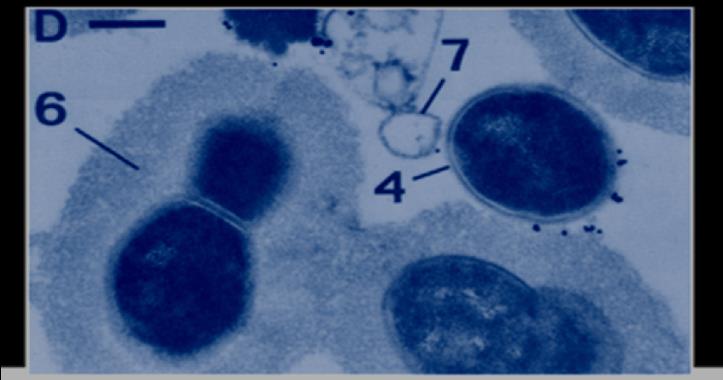 complemento ed interferisce con l opsonizzazione dei fagociti Sierotipi differenti hanno