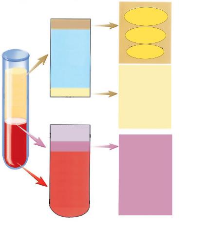 % in Peso % in Volume (5 litri) Plasma (% in peso) Proteine 7% Albumine 58% Globuline 38% Altri fluidi e tessuti 92% Sangue 8% Composizione del sangue Plasma 55% Elementi Figurati 45% Acqua 91% Altri