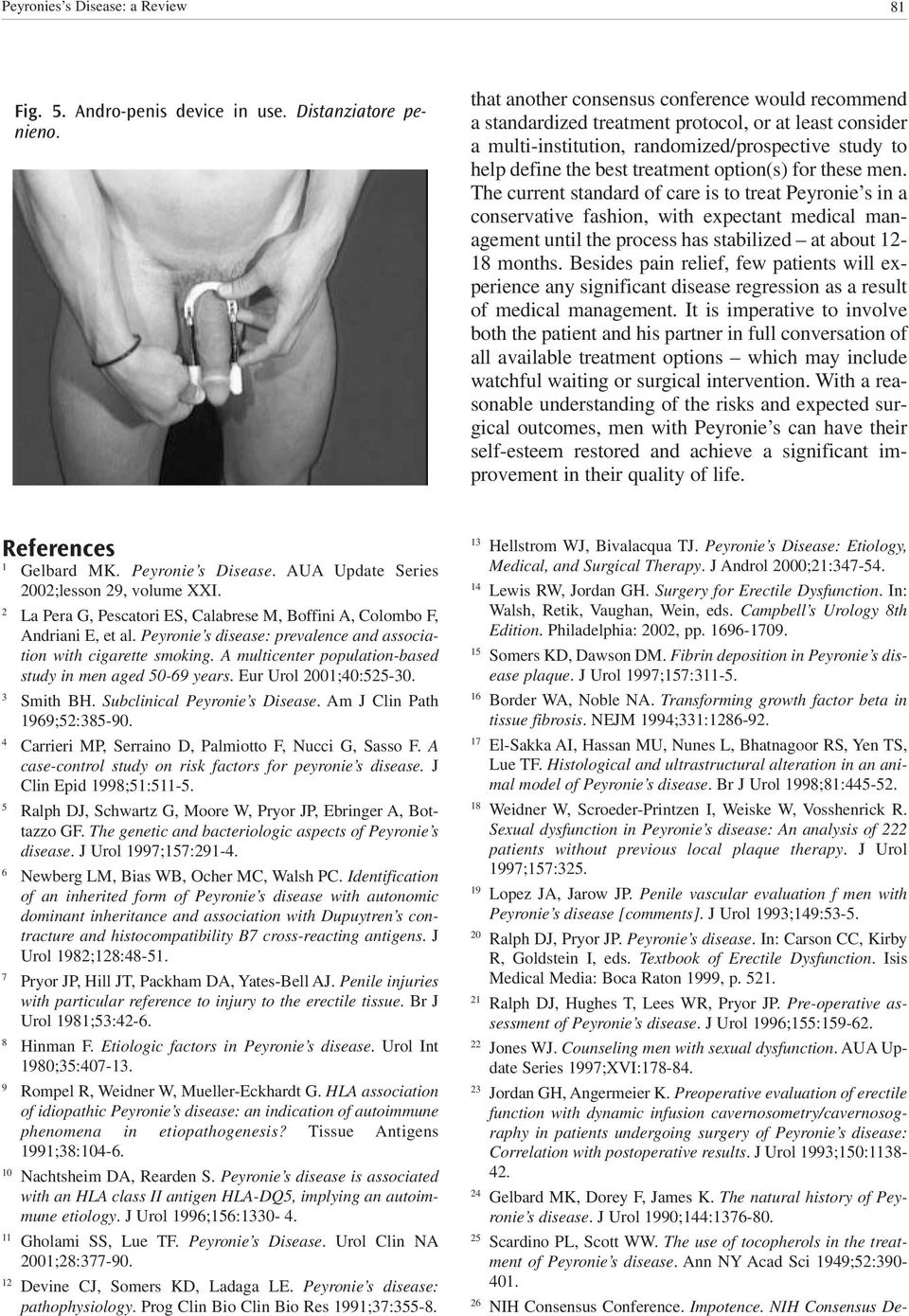 for these men. The current standard of care is to treat Peyronie s in a conservative fashion, with expectant medical management until the process has stabilized at about 12-18 months.