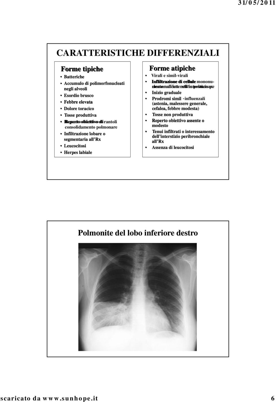 mononumononucleate nell interstizio nell interstizio polmonare p.